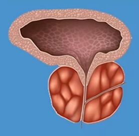 Signs characteristic of prostatitis