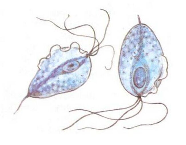 Trichomonas causative agents of prostatitis