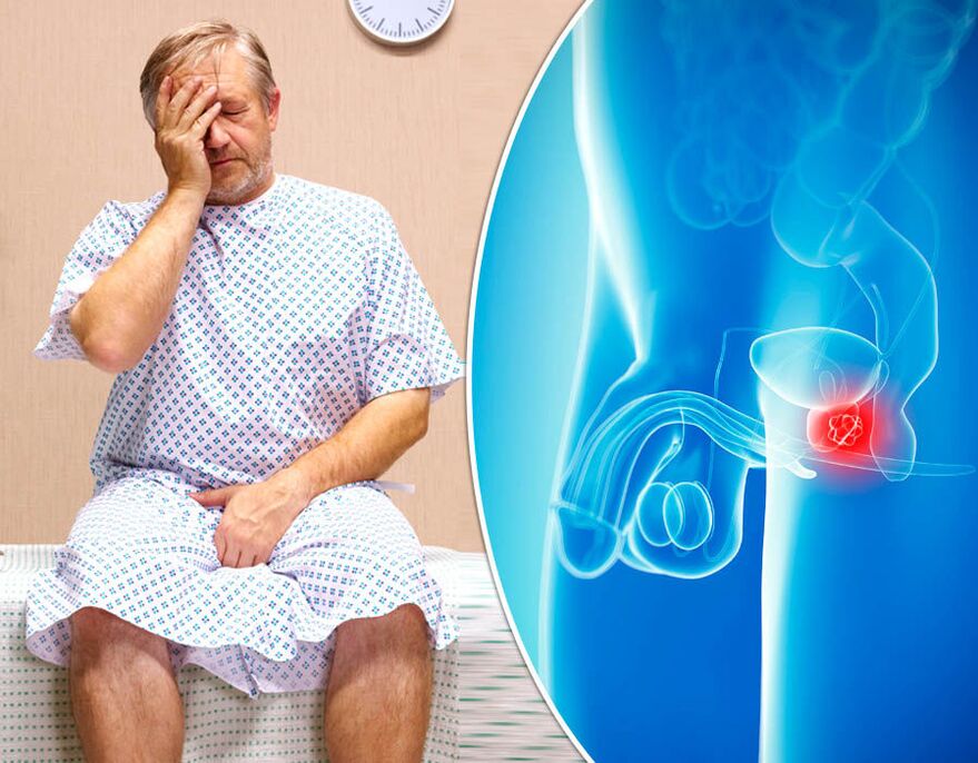 A man with prostatitis undergoes diagnosis of the disease
